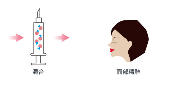 自体脂肪移植吸脂部位