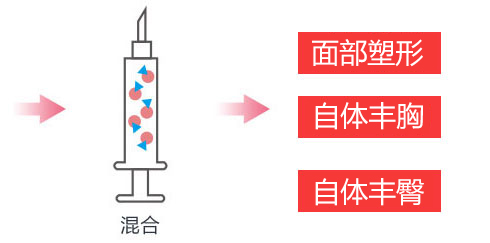自体脂肪移植填充部位