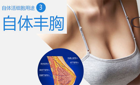 自体脂肪丰胸