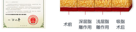 瘦腰腹8