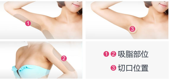 瘦手臂2
