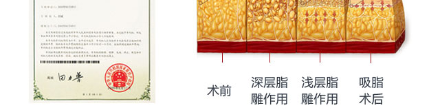 瘦腿11