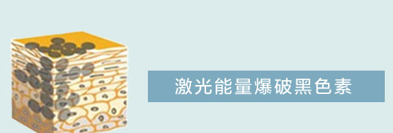 祛雀斑6