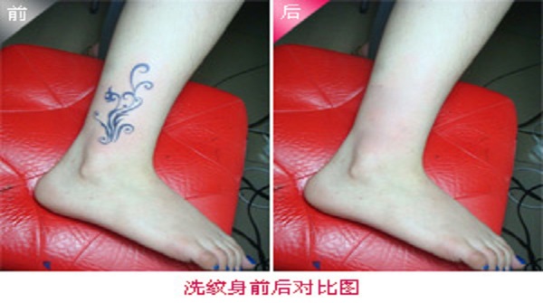 洗纹身1