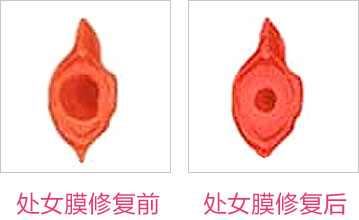 手术前后对比
