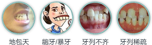 歪牙矫正3