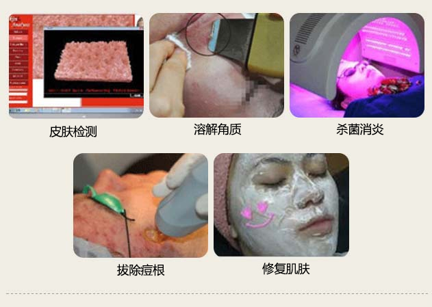 科学祛痘